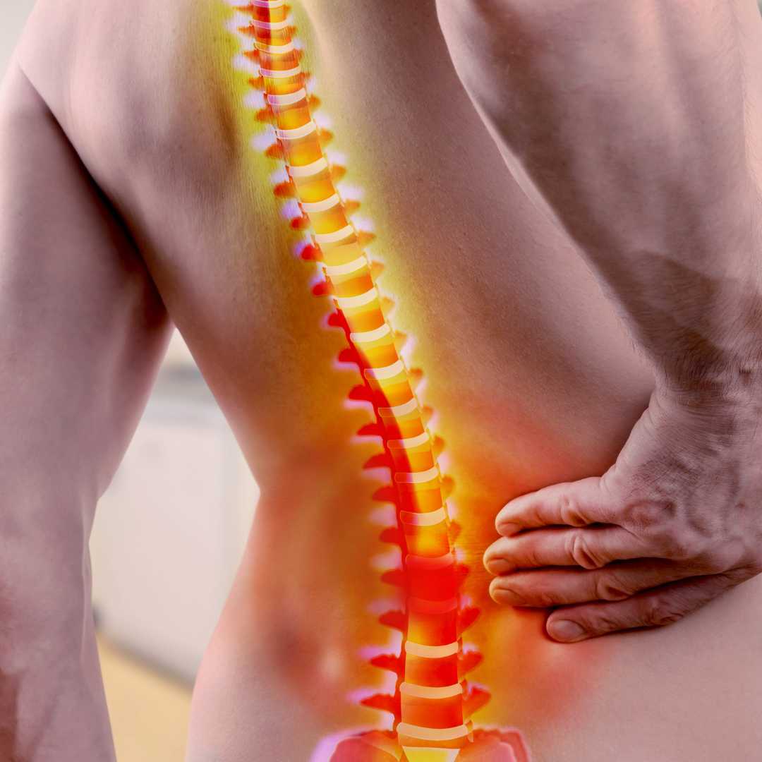 What is the Best Therapy for a Bulging Disc?