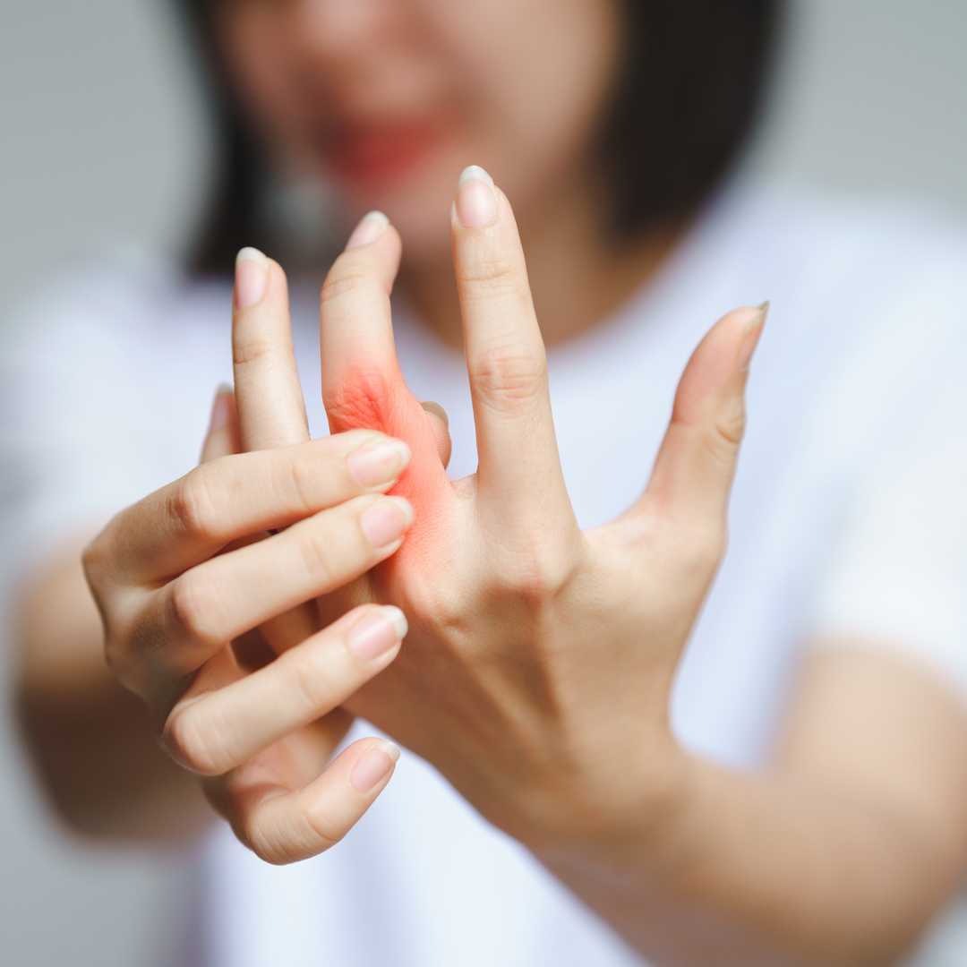 What is the New Treatment for CMC Joint Arthritis?