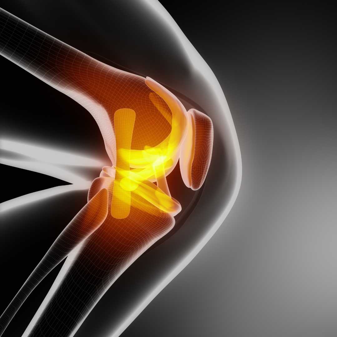 Can Stem Cell Therapy Regrow Cartilage?