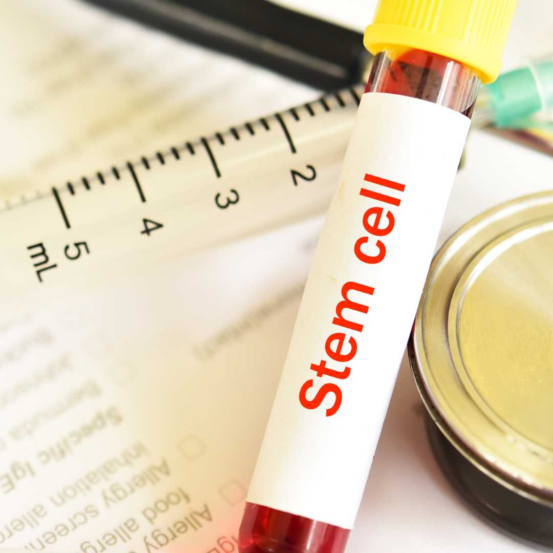 What is Stem Cell Therapy for Knees in Mexico?