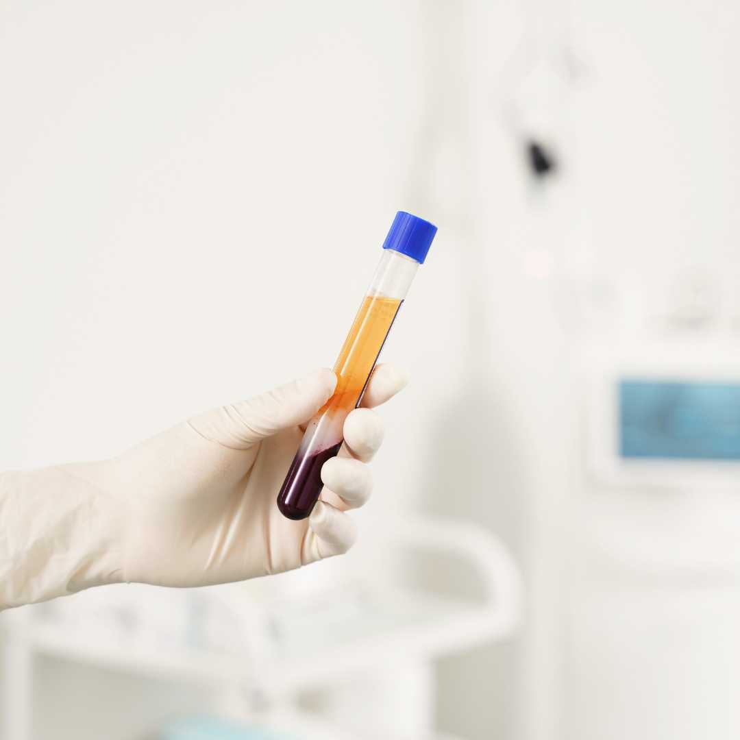 How Much do Platelet Rich Plasma PRP Injections Cost?