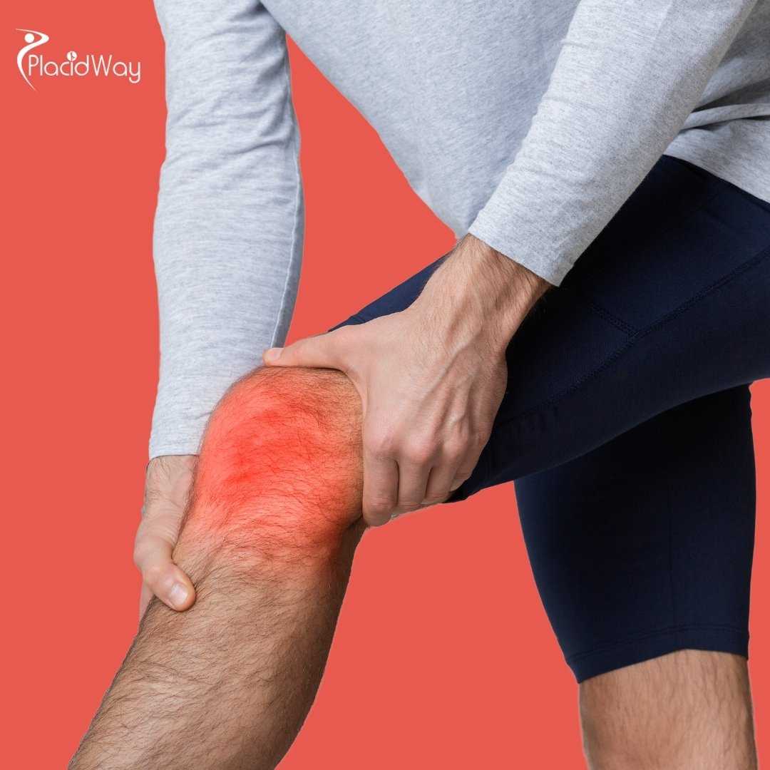 Is Stem Cell Therapy for Knees in Mexico Better Than Knee Replacement?