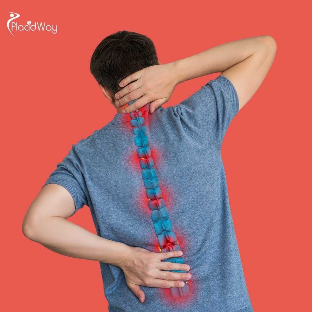 What Is the Cost of Stem Cell Treatment for Spinal Cord Injury in Mexico?