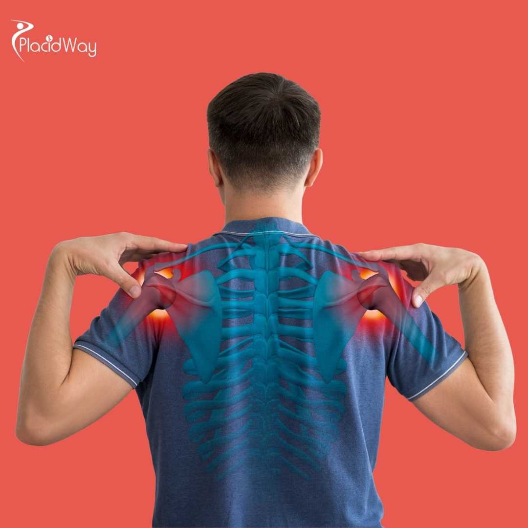 Is Stem Cell Treatment a Good Alternative to Shoulder Surgery in Mexico?