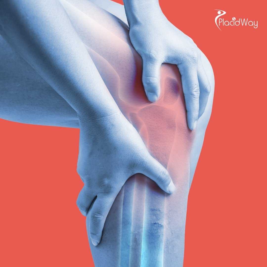 What Brands of Knee Implants Are Used in Mexico?