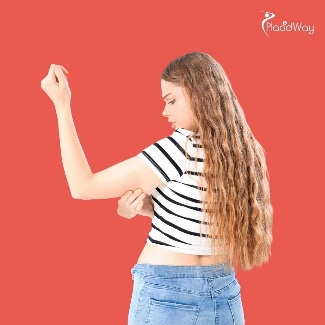 What Is the Price for an Arm Lift in Thailand?