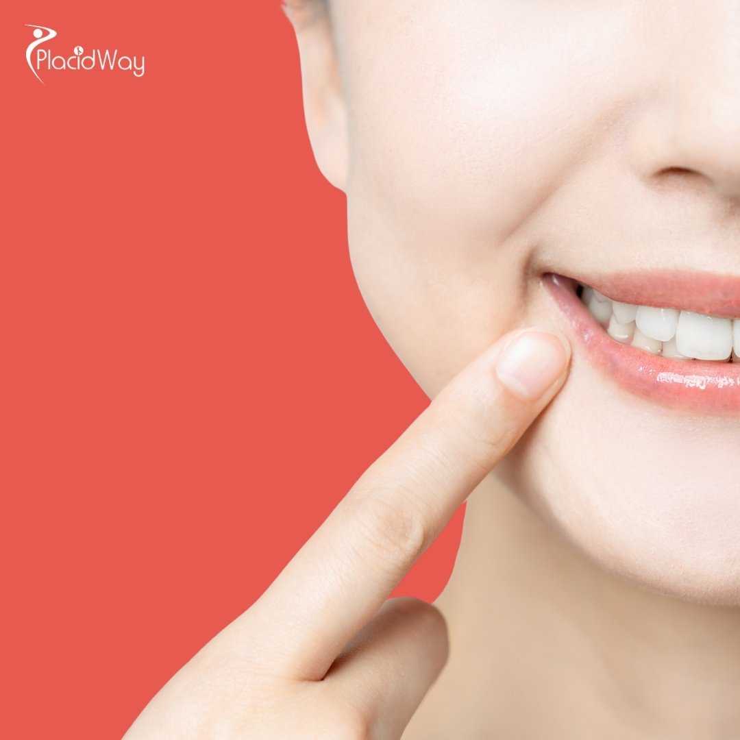 What Is the Price for an E-max Crown in Colombia?