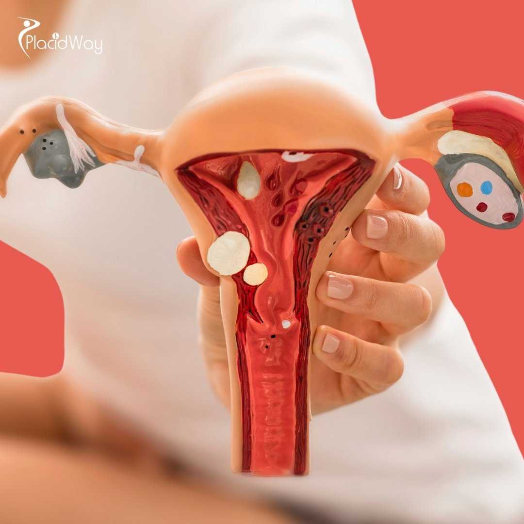 Is It Safe to Get a Labiaplasty in Mexico?