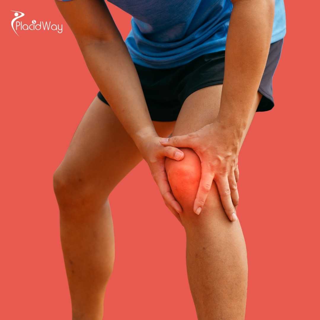 How Much Does Stem Cell Therapy for Knee Arthritis Cost in Mexico?