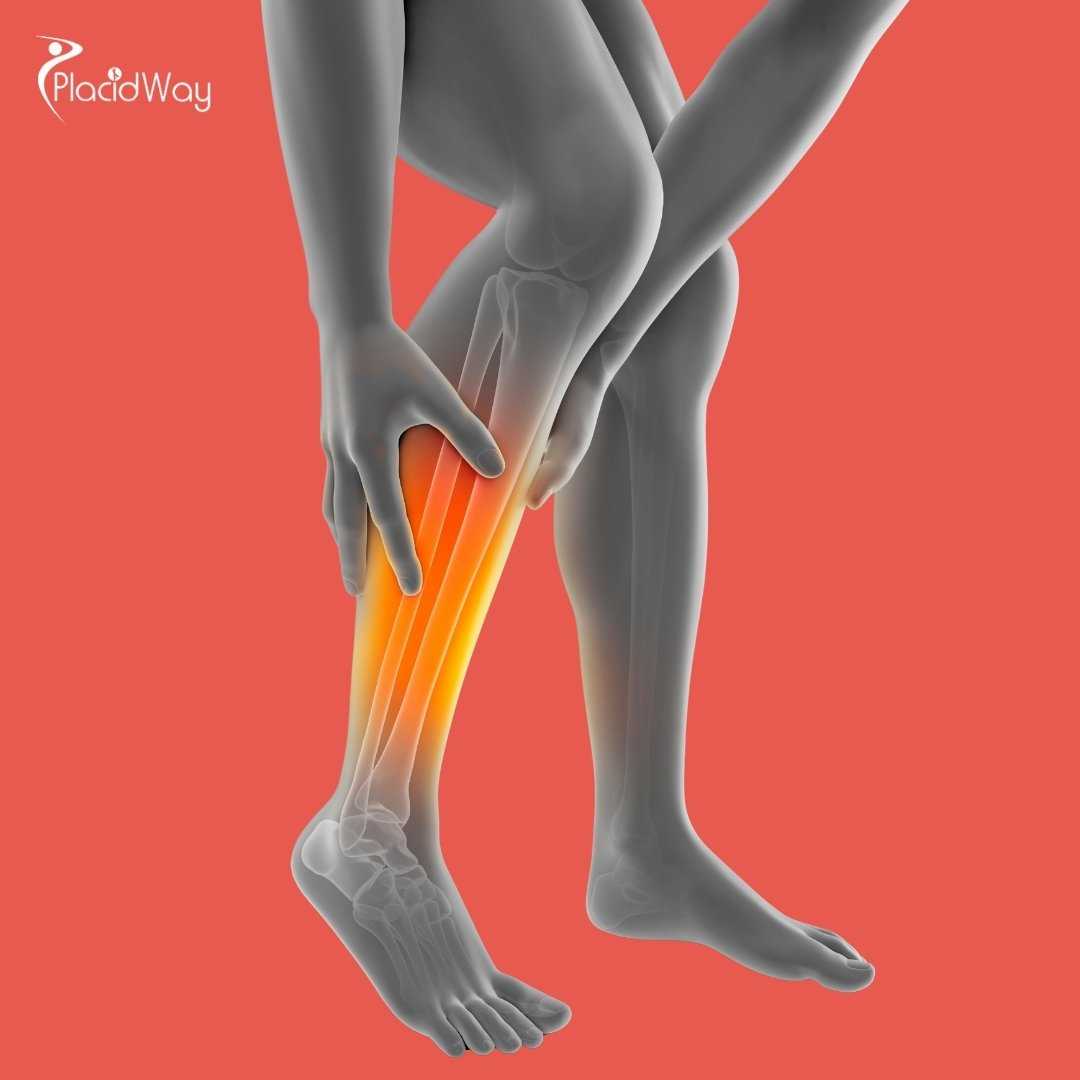 How to Prepare for Calf Implant Surgery in Mexico