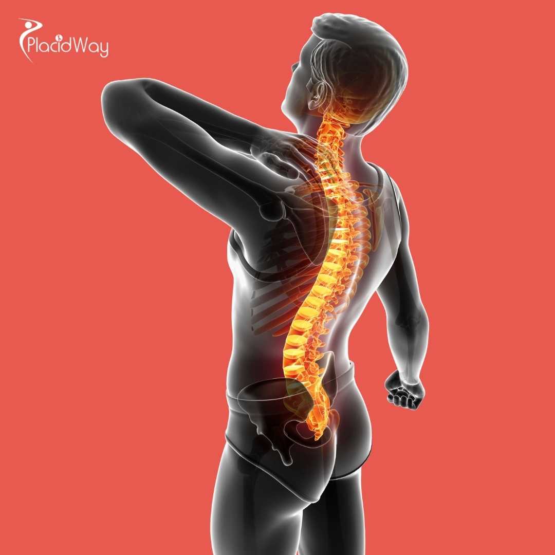 Can Stem Cell Treatment in Mexico Slow MND (Like ALS)?