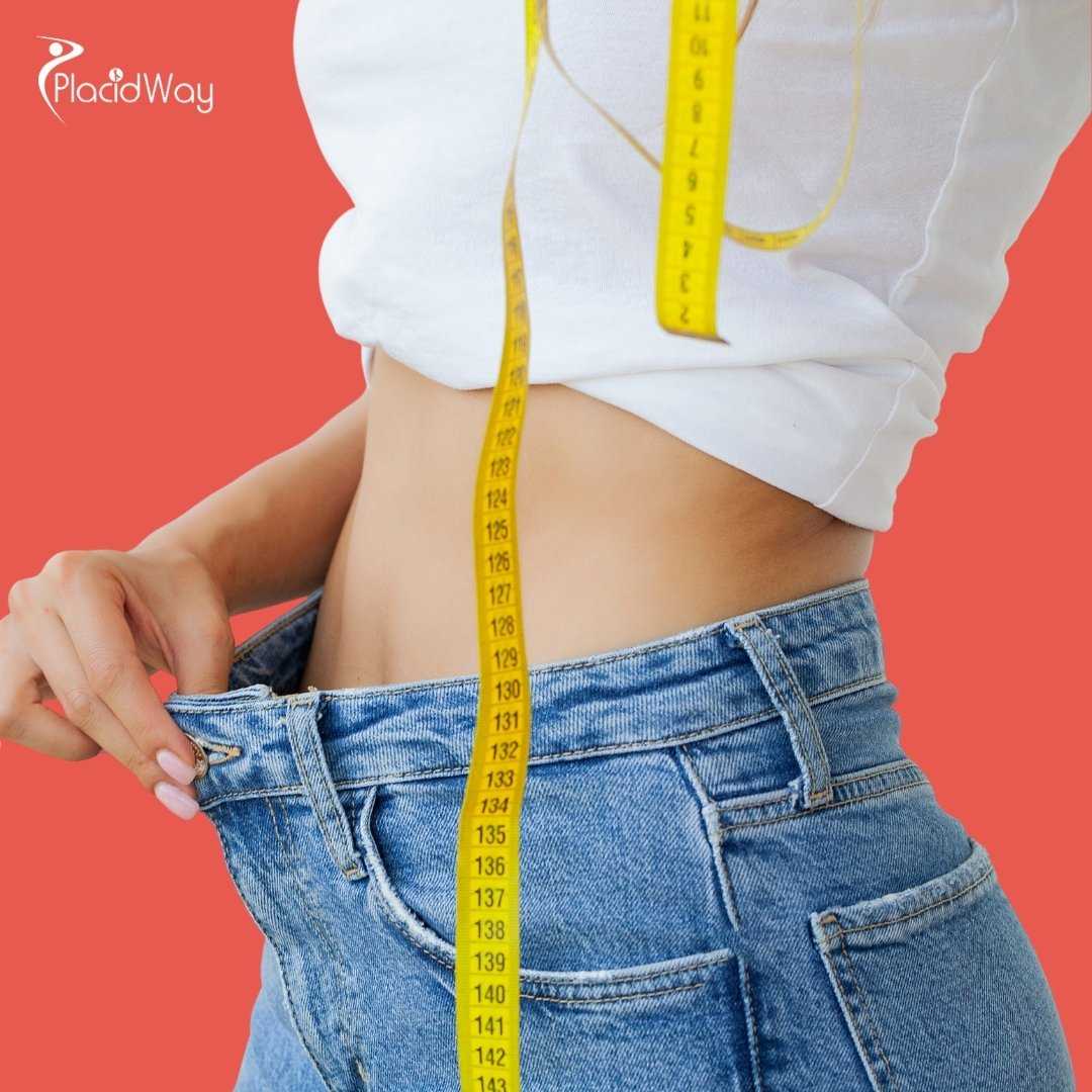 What Is the Recovery Like for a Mini Gastric Bypass in Mexico?