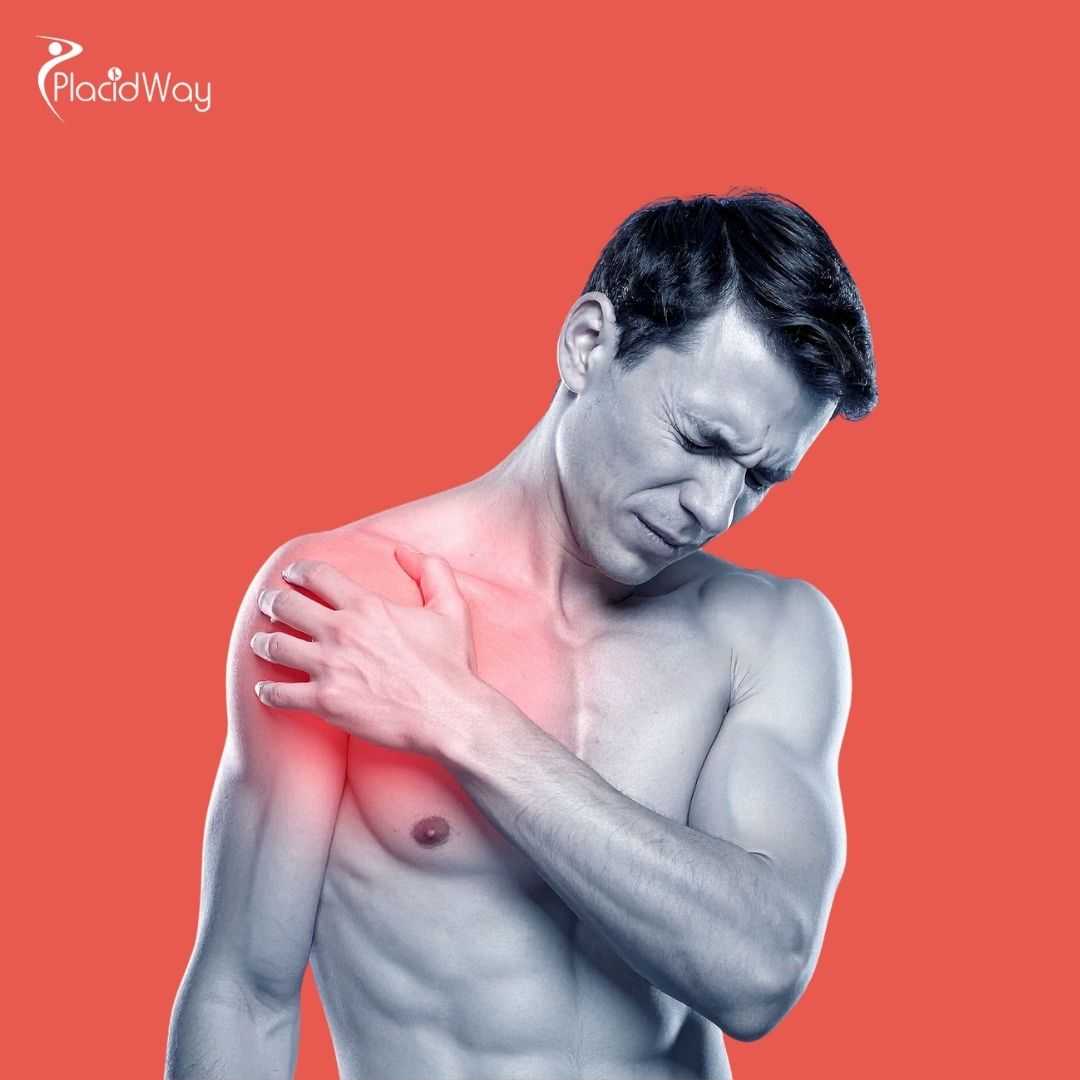 What Is the Cost of Stem Cell Therapy for Psoriatic Arthritis in Mexico?