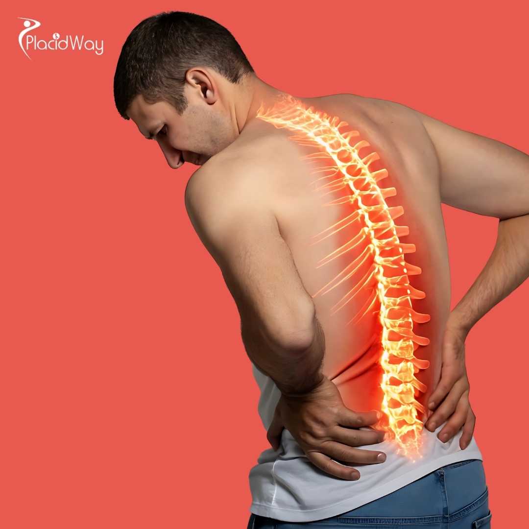 How Much Does Stem Cell Therapy for Spinal Stenosis Cost in Mexico?