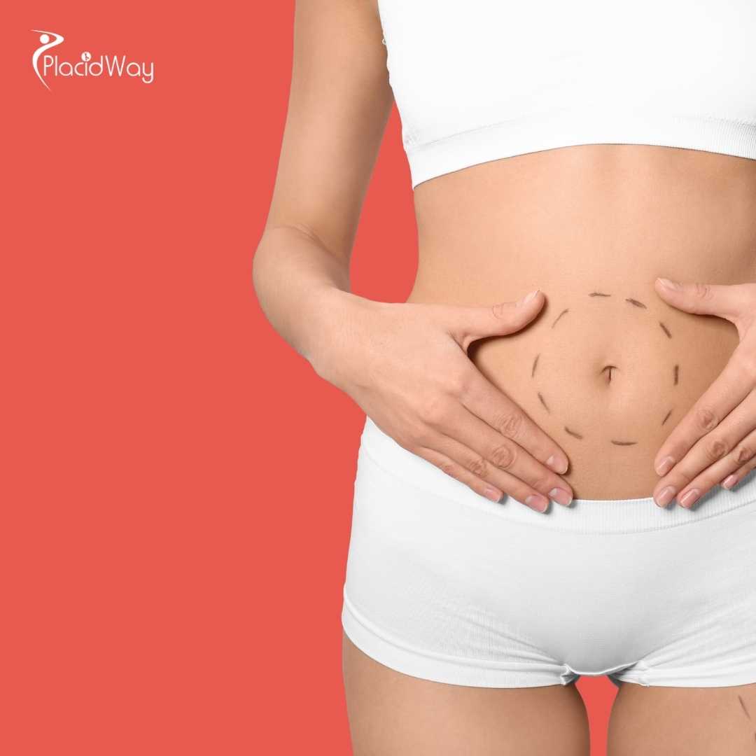 Liposculpture vs. Liposuction in Thailand: What Is the Real Difference?