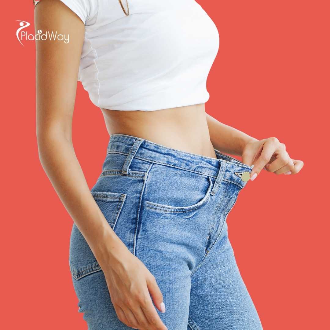 What Are the Requirements for a Mini Gastric Bypass in Turkey?