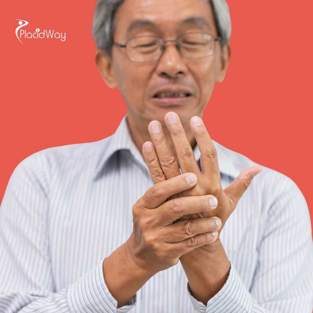 What Is the Cost of Trigger Finger Release Surgery in Mexico?