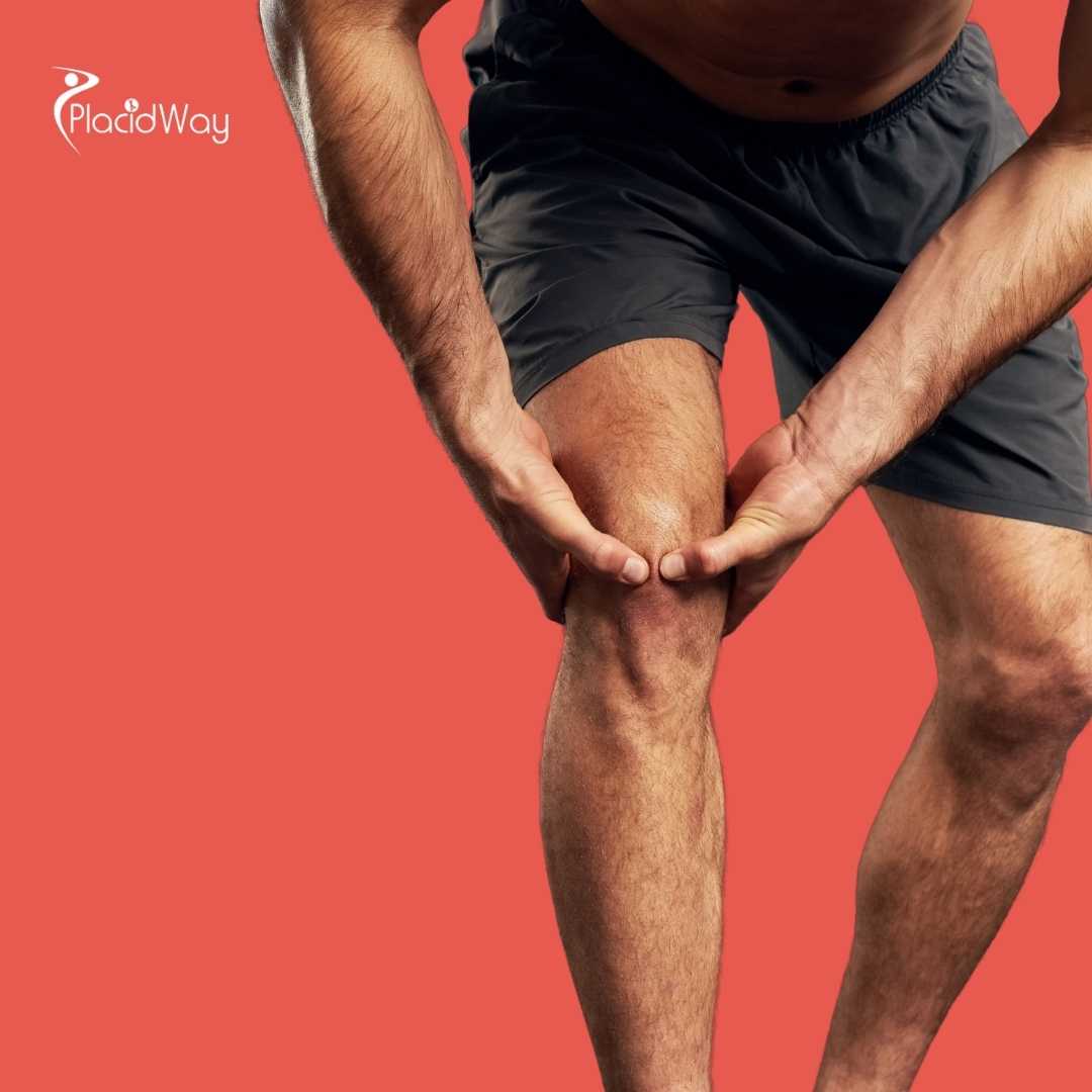 What Type of Grafts Are Used for ACL Repair in Mexico?