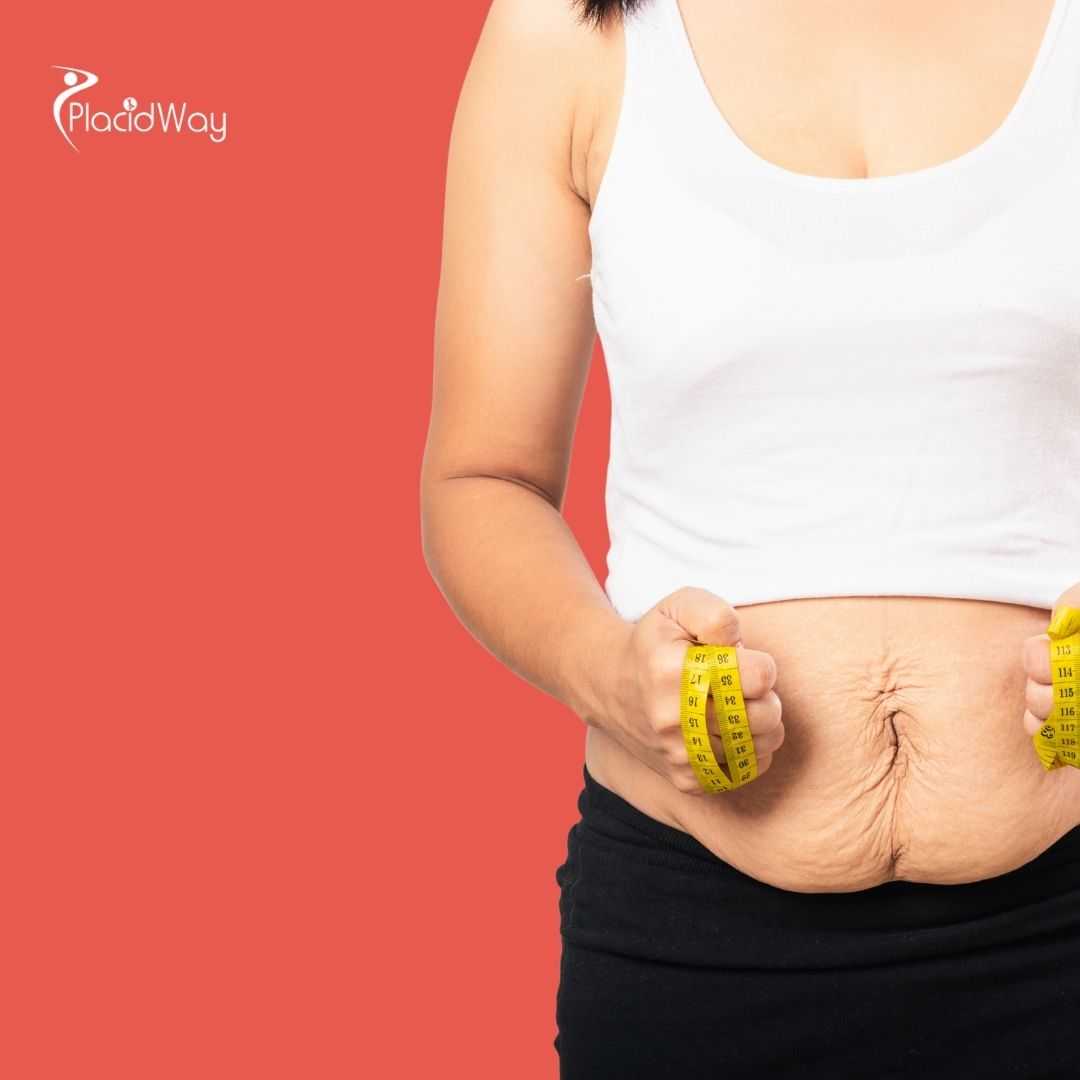 How Much Fat Can Be Removed With Liposuction in Thailand?
