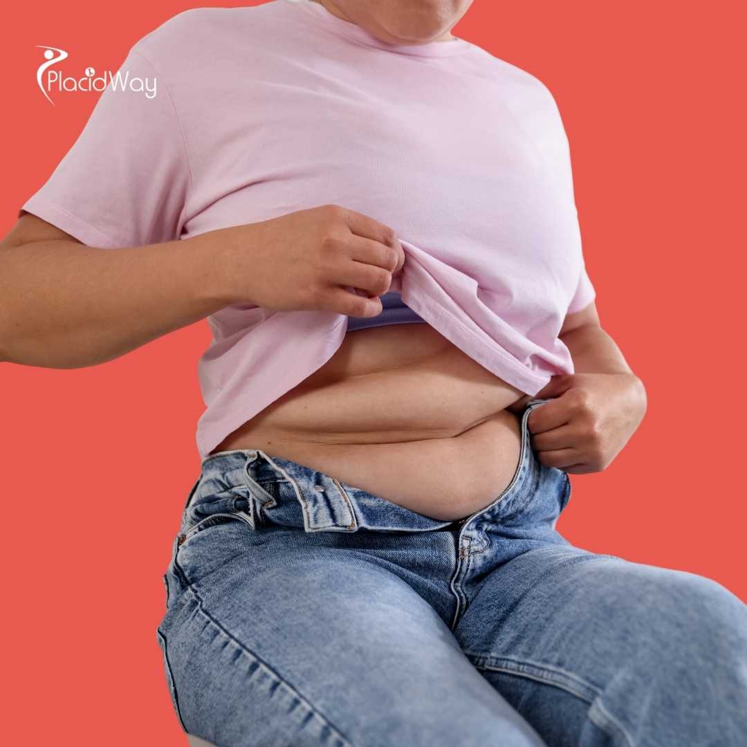 Is Full Body Liposuction in Thailand Safe?