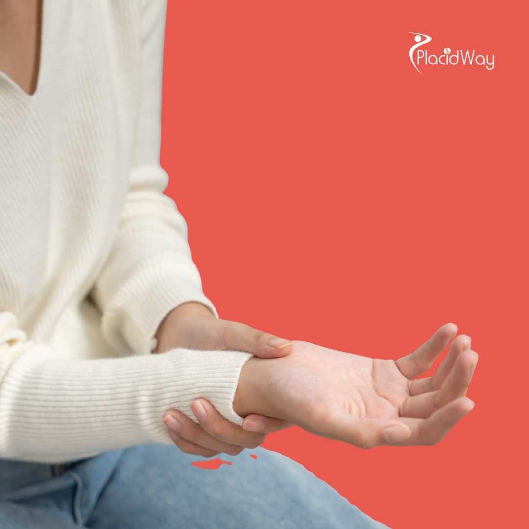 Can Stem Cells in Mexico Treat Carpal Tunnel Syndrome?