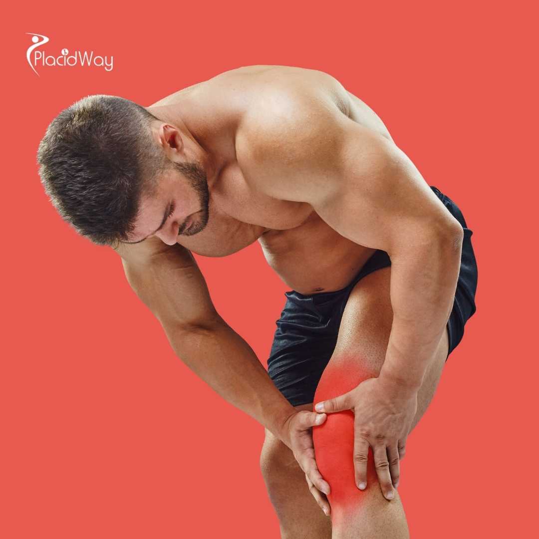 What Is the Price for ACL Reconstruction in Mexico vs. the US?