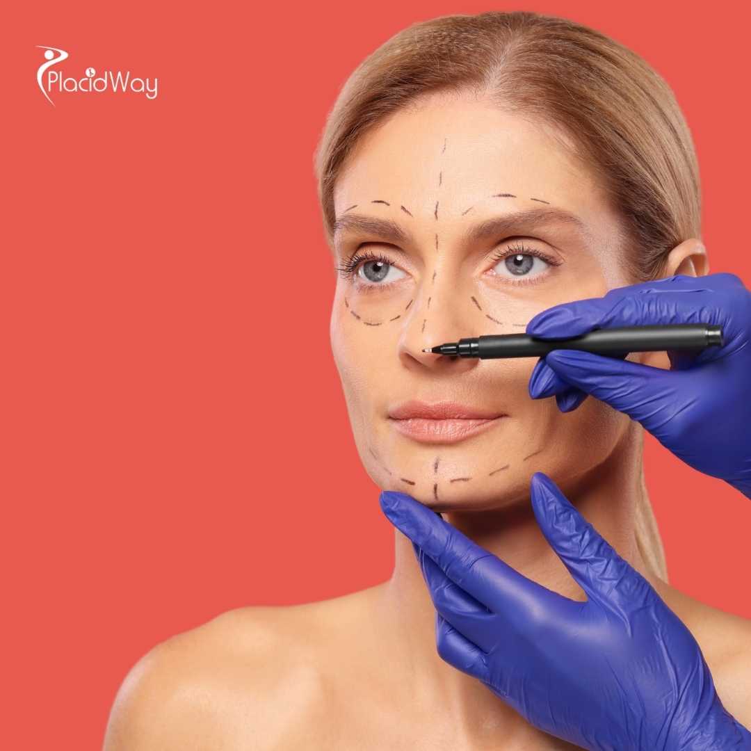 How Much Is a Revision Rhinoplasty in Mexico?