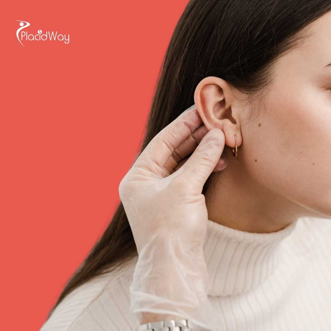 How Long Do Otoplasty Results Last From Mexico?