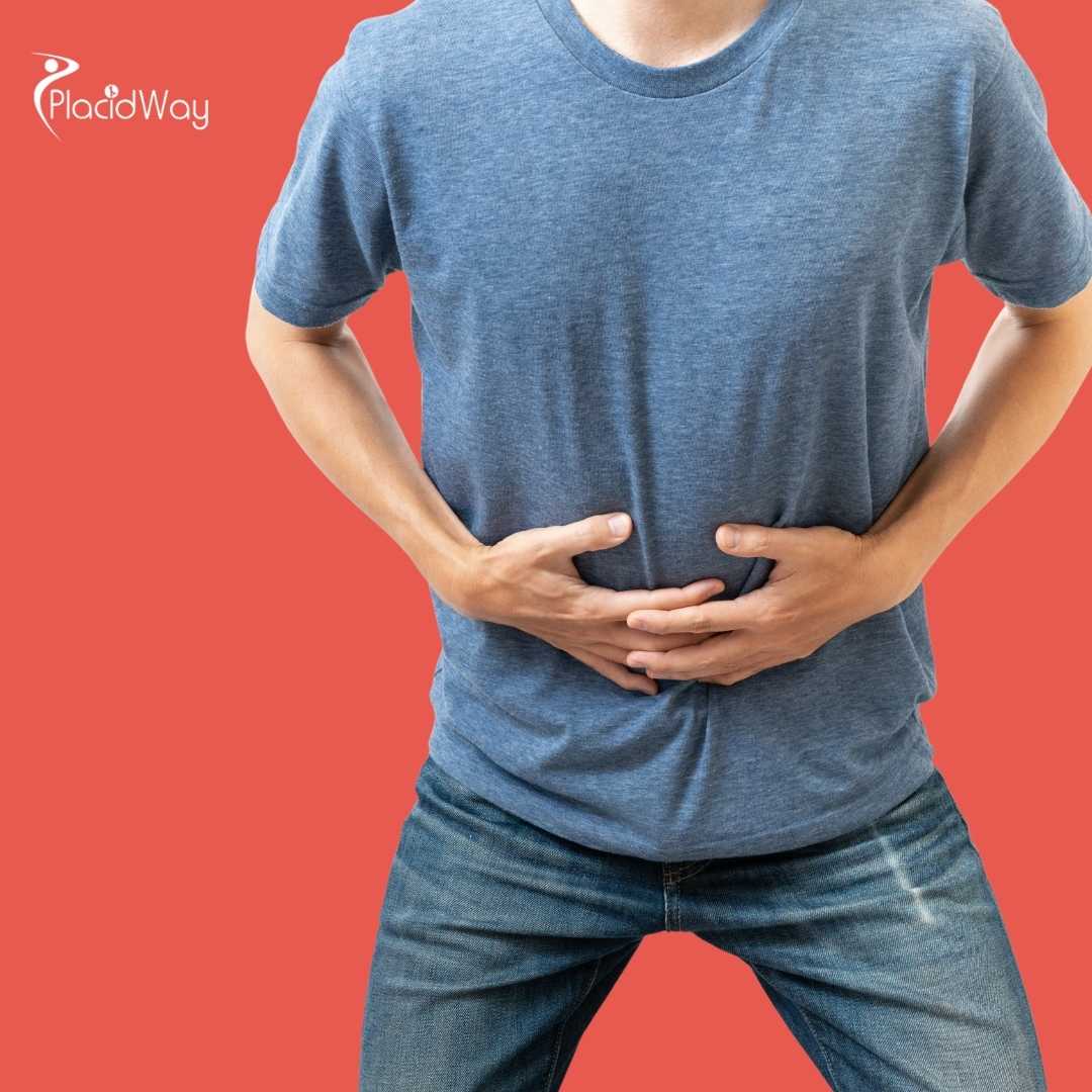 Is EndoBarrier Safe in Mexico?