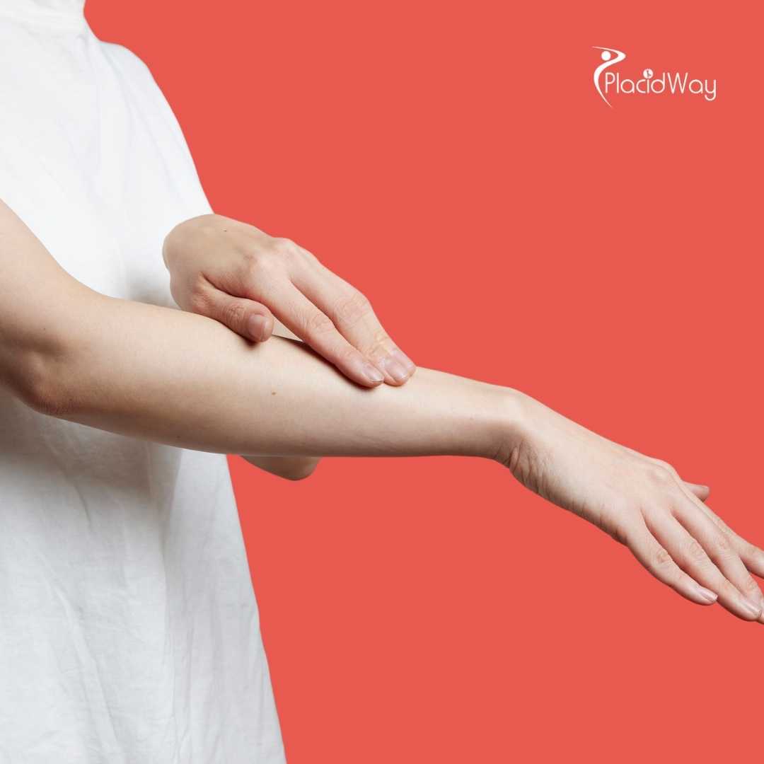 What Are the Risks of Arm Lift Surgery in Mexico?