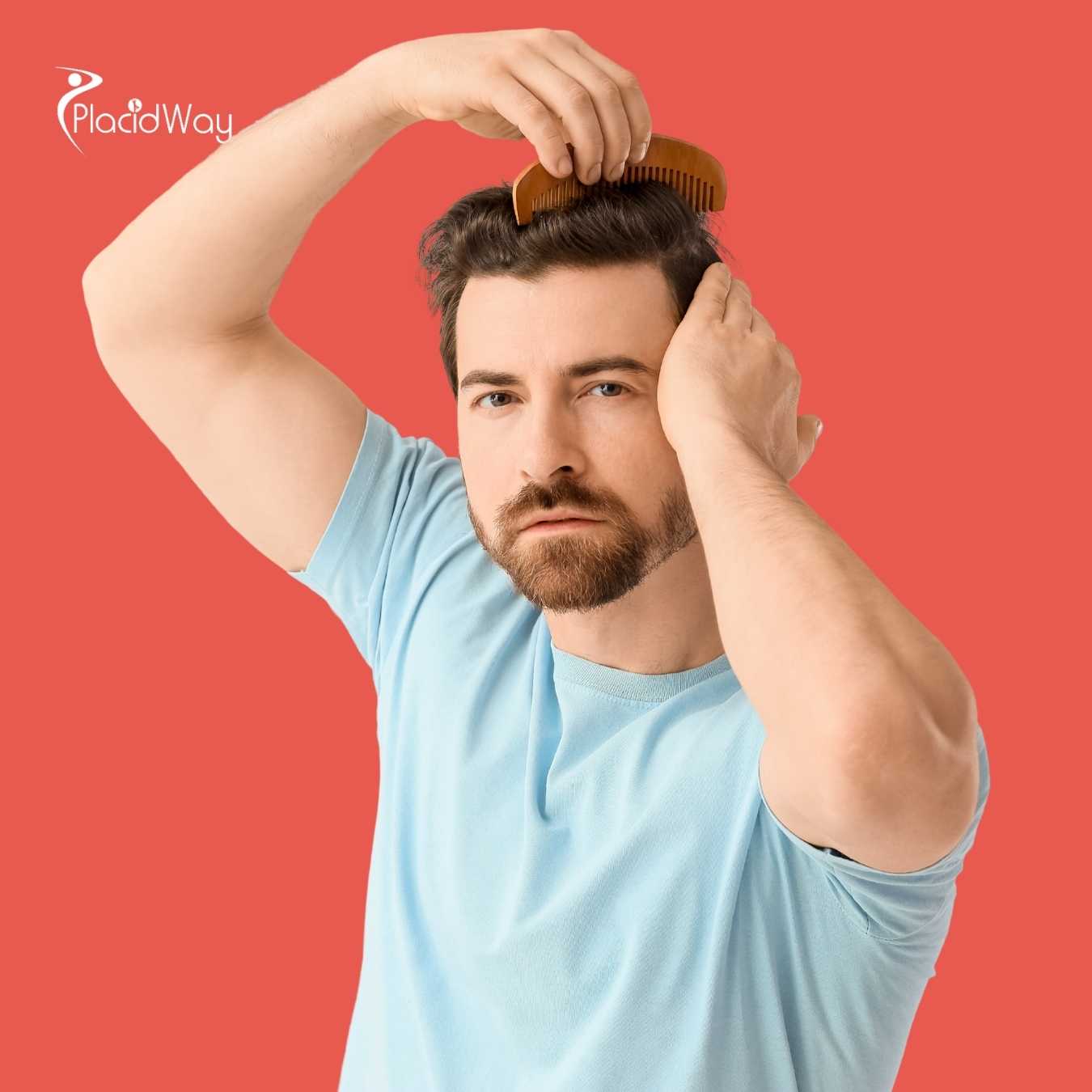 Hair Transplant Mexico Before and After Photos?