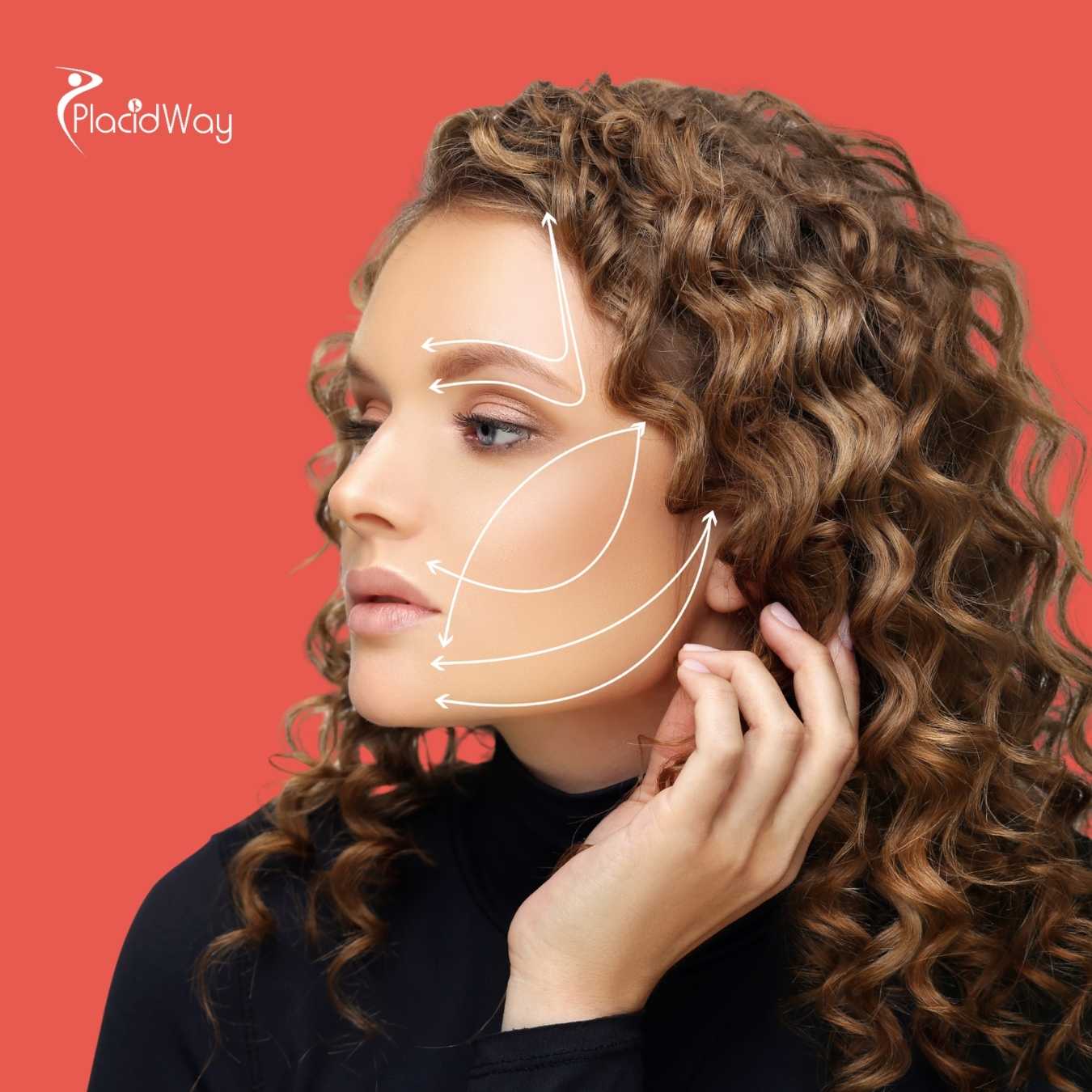 Does a Thread Lift in Mexico Really Work?