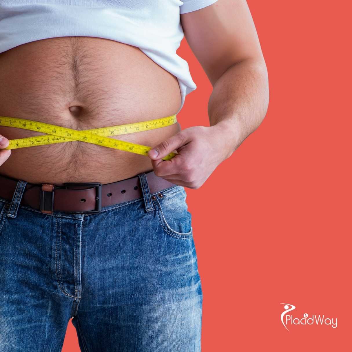 What Is the Cost of Gastric Bypass for Diabetes in Mexico?
