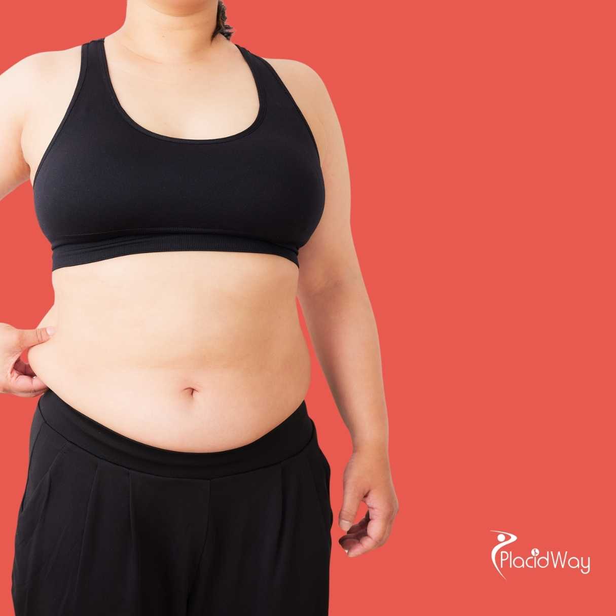 Who Qualifies for Gastroplasty in Mexico?