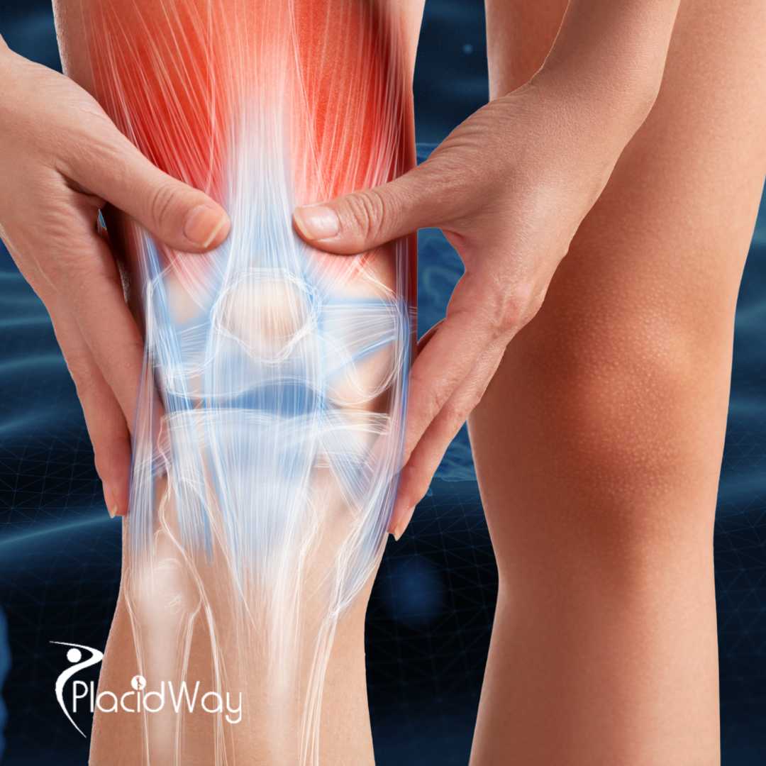 Comparing PRP vs. Stem Cell Knee Treatments in Japan: Which Works Better?