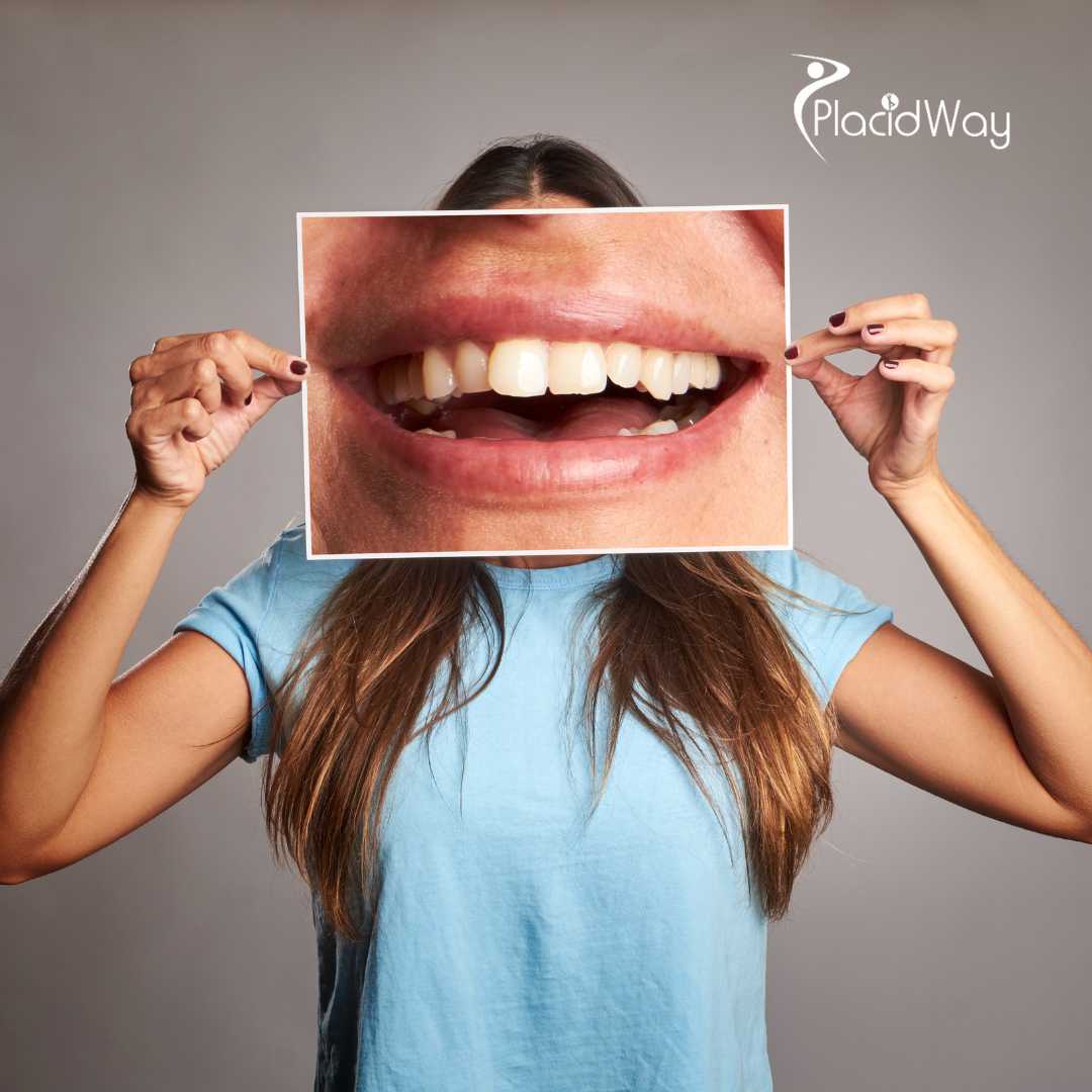 Is South Korea a Good Destination for Full Mouth Restoration?