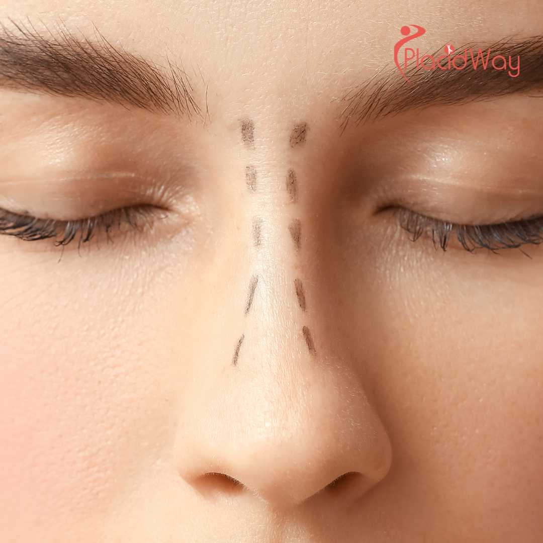 Is Bridge Augmentation Safe in South Korea?