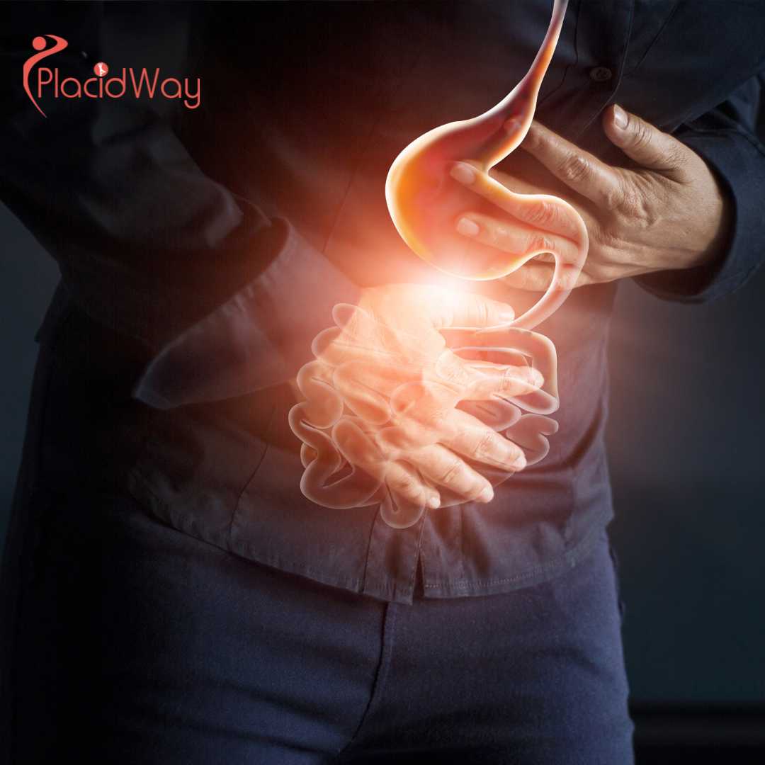 Is Mini Gastric Bypass Surgery in Mexicali, Mexico Safe?