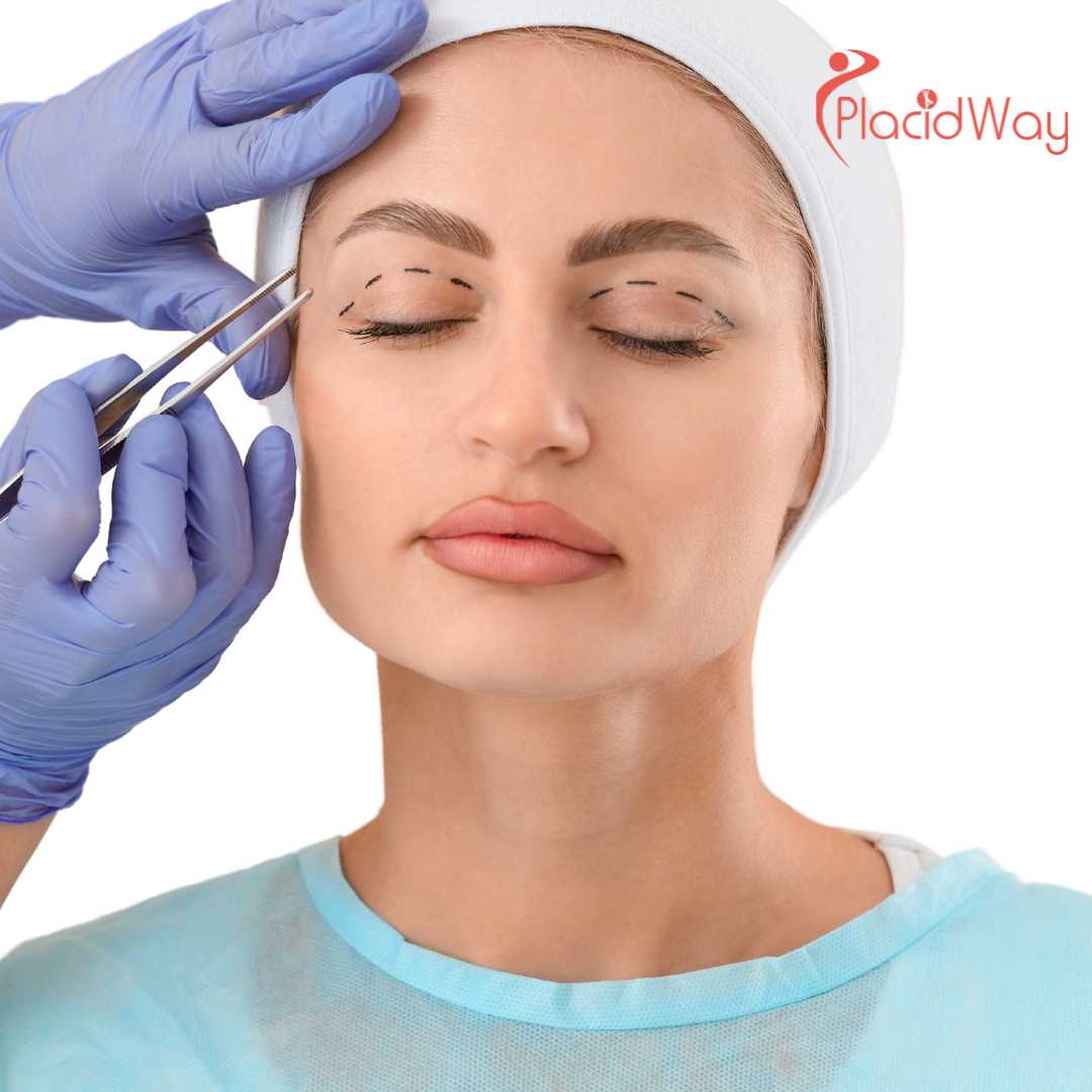 Is Blepharoplasty in South Korea Safe for Foreigners?
