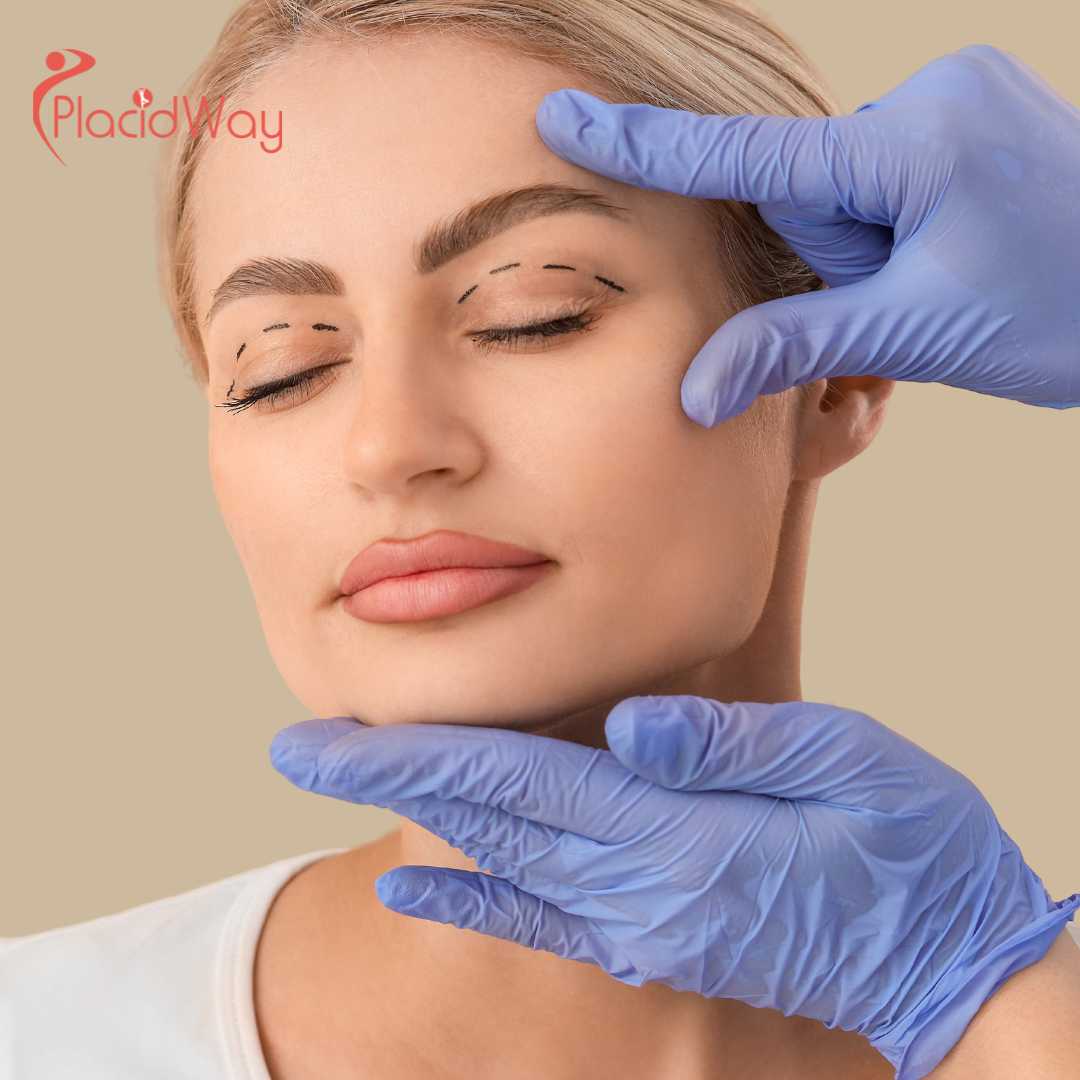 How Much Does Double Eyelid Surgery Cost in South Korea?