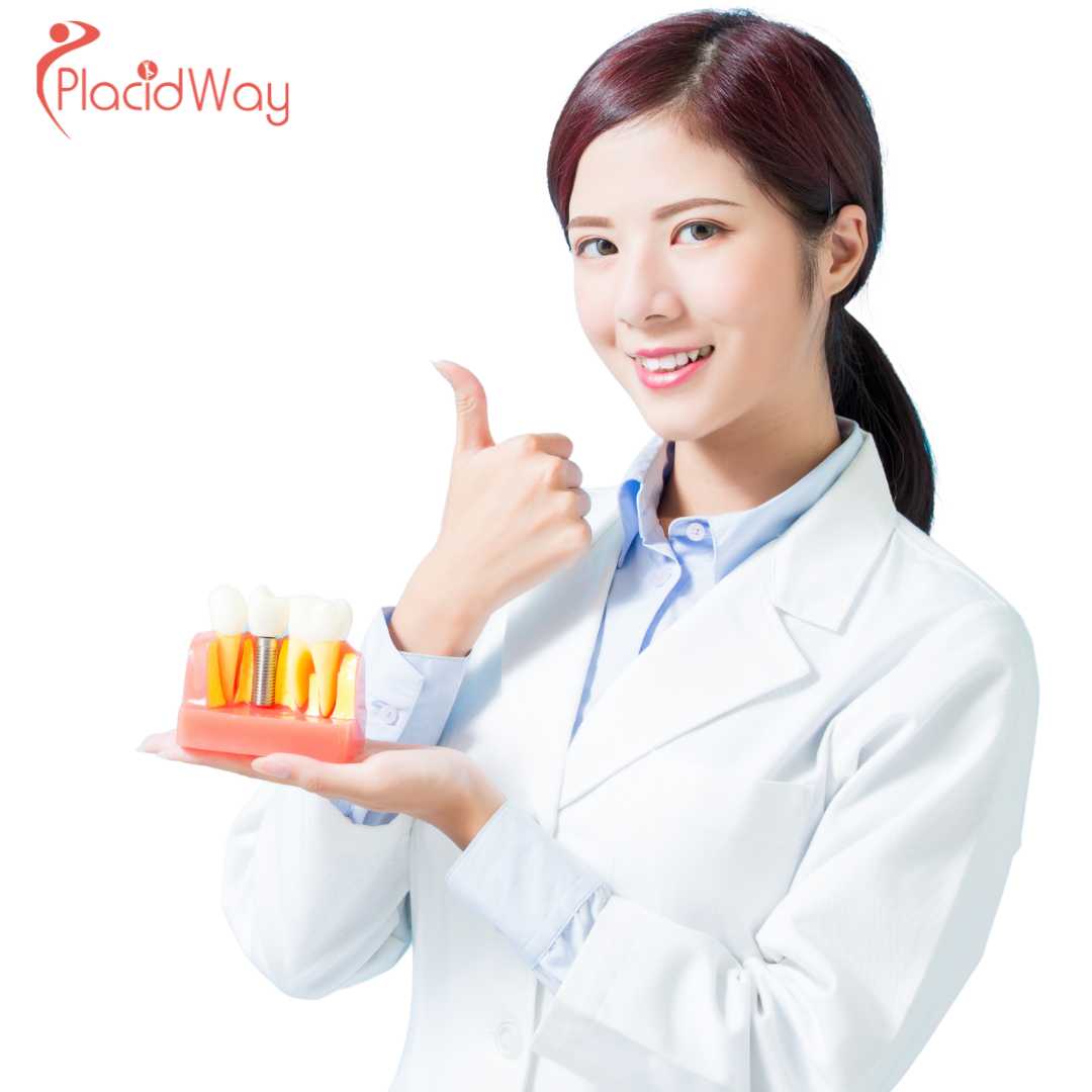 How Long Do Full Arch Implants Take in Korea?