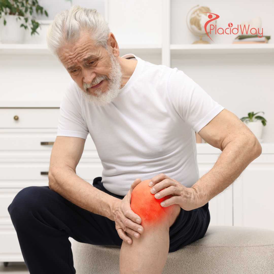 How Effective Is Stem Cell Therapy In Mexico For Knee Osteoarthritis?