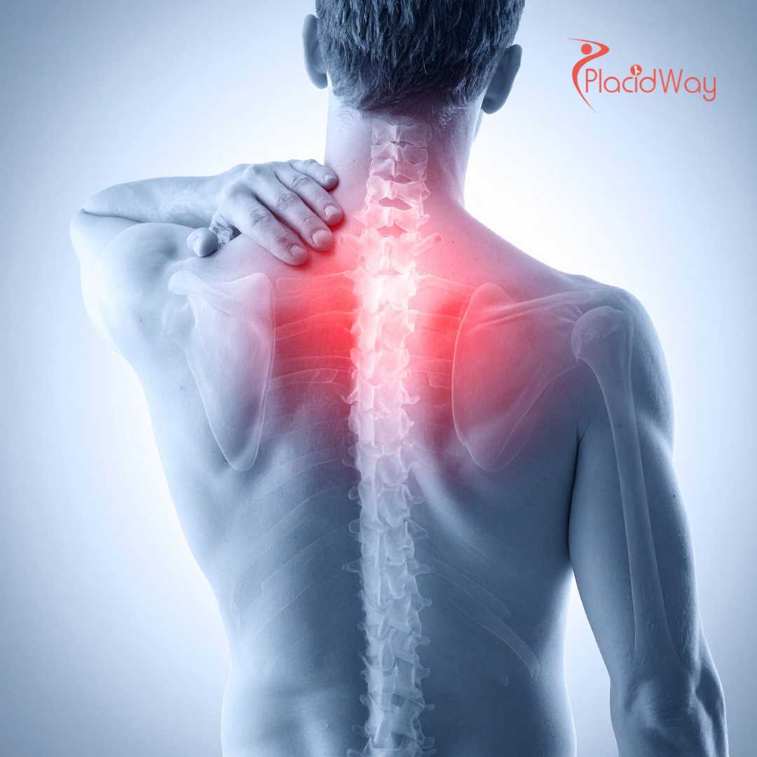 Can Spinal Cord Injury Stem Cell Therapy in Tokyo, Japan Help Recovery?