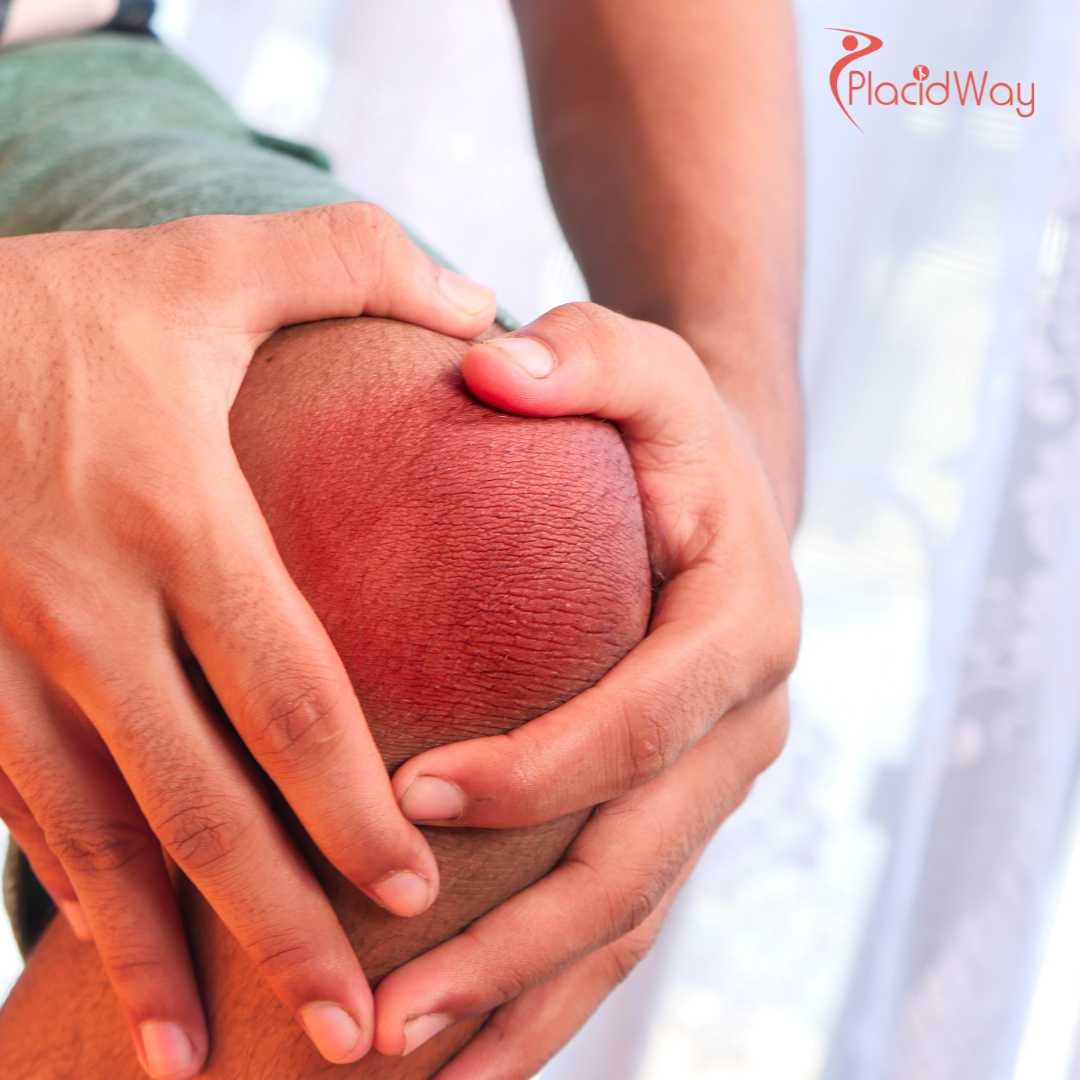 Combine Recovery With Vacation Knee Stem Cell Therapy in Puerto Vallarta for Canadians