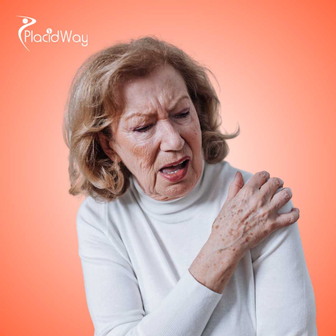 Managing Rheumatoid Arthritis Canadian Patients Find Relief in Tijuana’s Specialized Centers