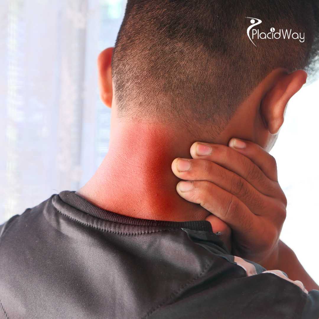 Managing Autoimmune Flare-ups US RA Patients Turn to Guadalajara’s Stem Cell Experts