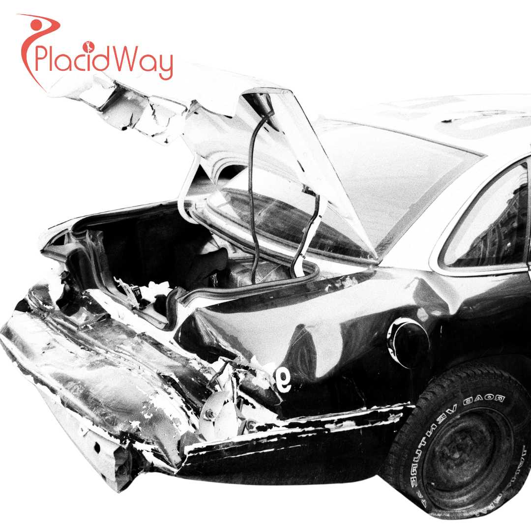 Sarah from Los Angeles’ Journey of Healing from PTSD with Ibogaine in Mexico