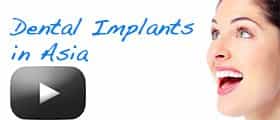 Dental Implant Clinics in Asia-Top dentistry options abroad