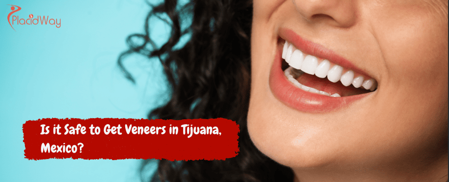 ¿Es seguro hacerse carillas en Tijuana, México?