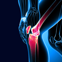Economical Package for ACL Repair in Hermosillo Mexico